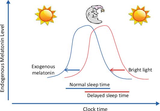 Delayed Sleep Phase Syndrome | Semantic Scholar