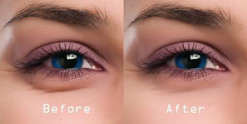 Best 6 home remedies to get rid of dark circles | Latest Fashion Trends